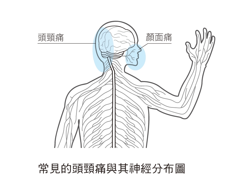 解決頭痛問題！頭頸痛根源在這三部位、常見的頭痛問題有這些
