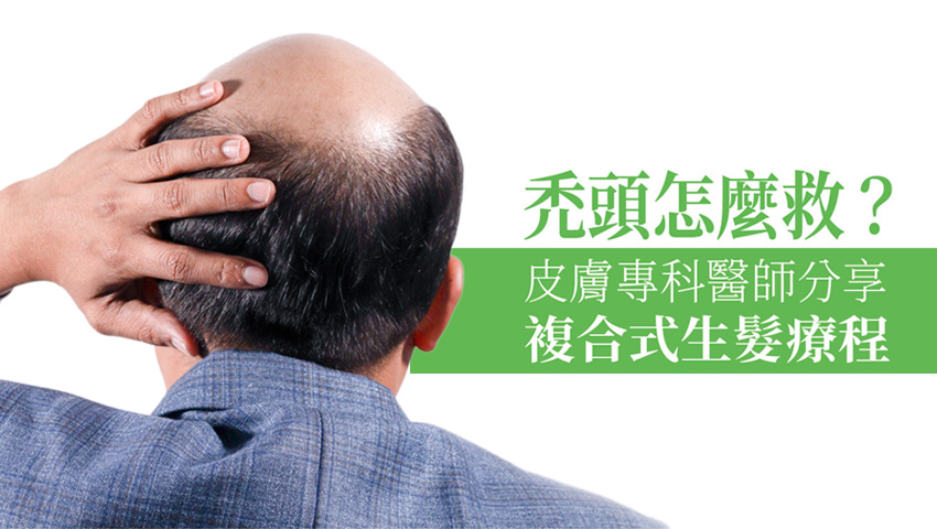 禿頭怎麼救？皮膚專科醫師分享複合式生髮療程