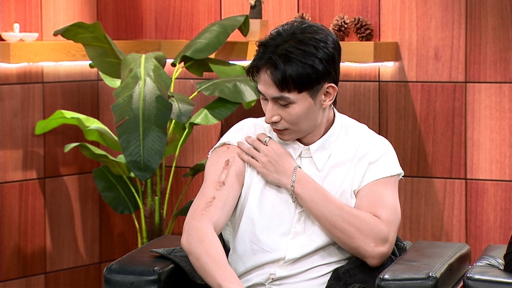 《全明星》男星手臂痠痛竟罹癌！醫警告嚴重恐截肢　緊急開刀狀況曝