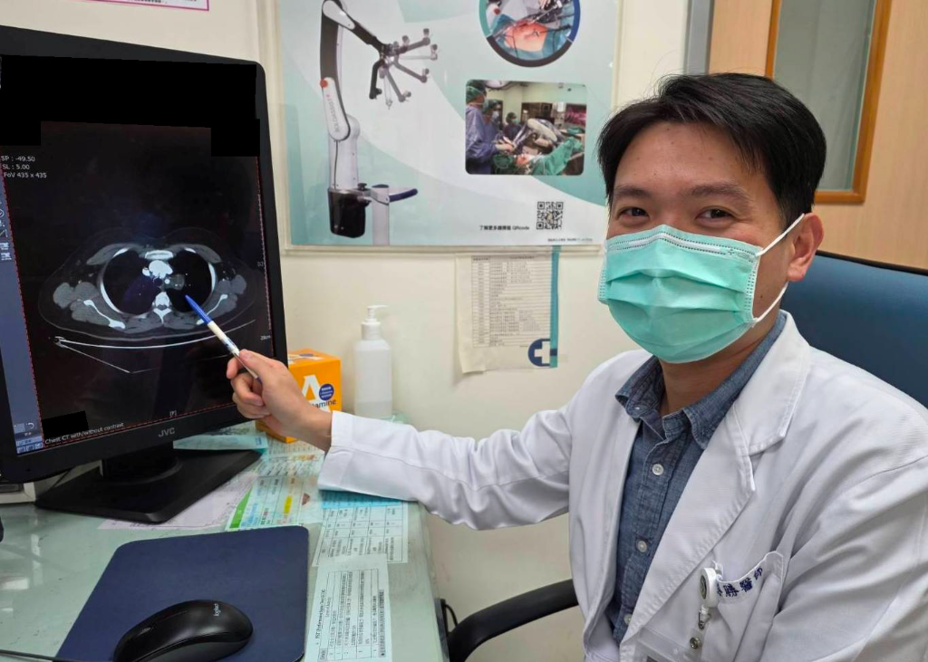胸腔突現「畸胎瘤」！無咳嗽、無胸悶　醫：手術切開見「毛髮、牙齒」